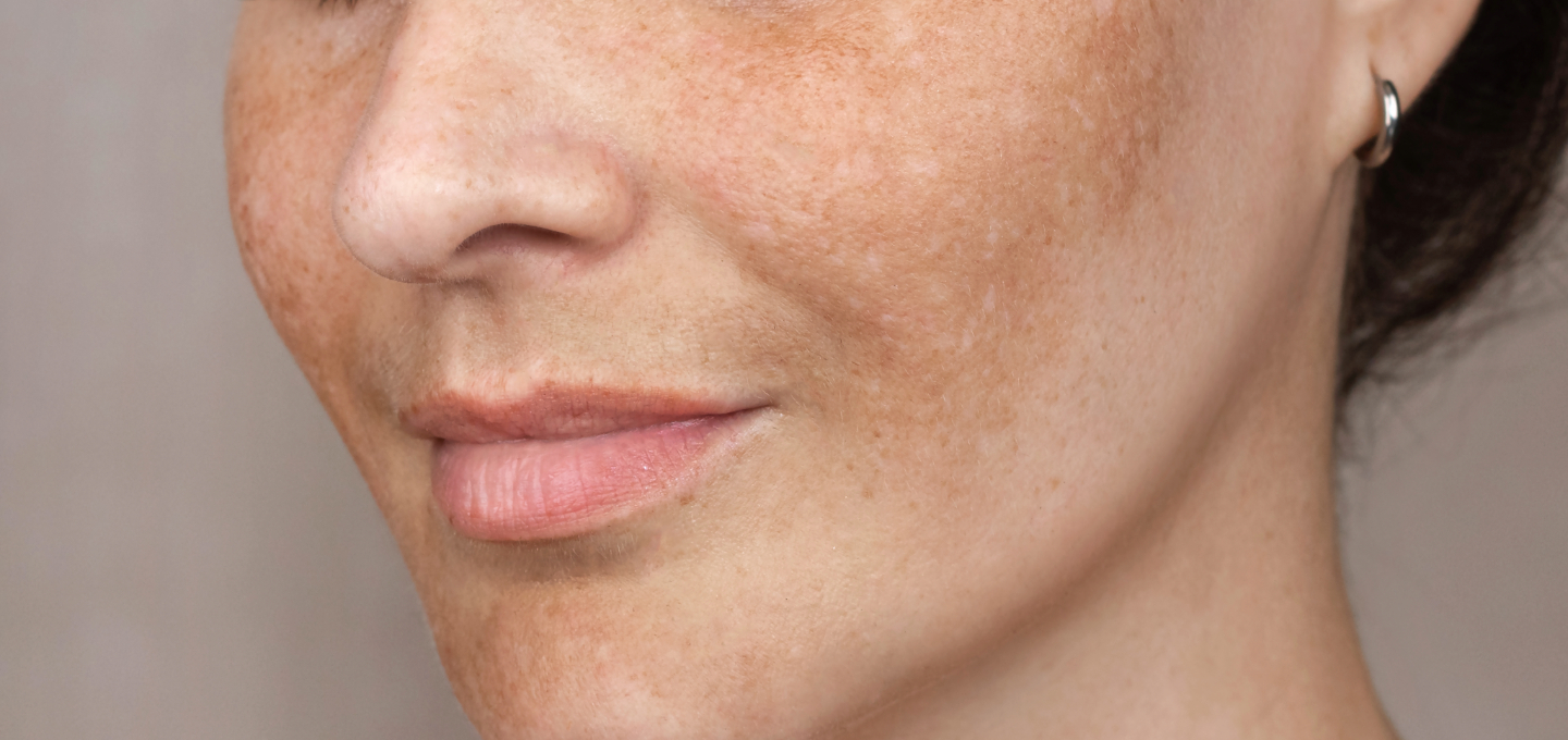Macchie in gravidanza: come riconoscerle, prevenirle e gestirle